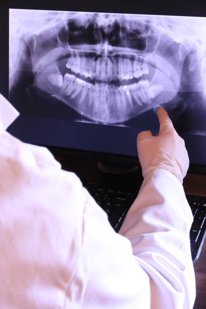 Best Emergency Tooth Extraction in Berkley, CO