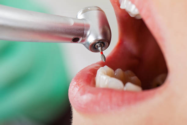 Best Pediatric Emergency Dentist in Berkley, CO